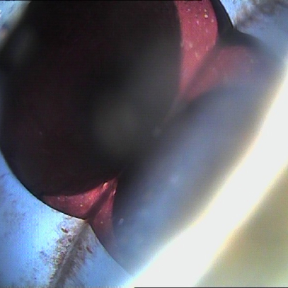 Improper Repairs or Transitions